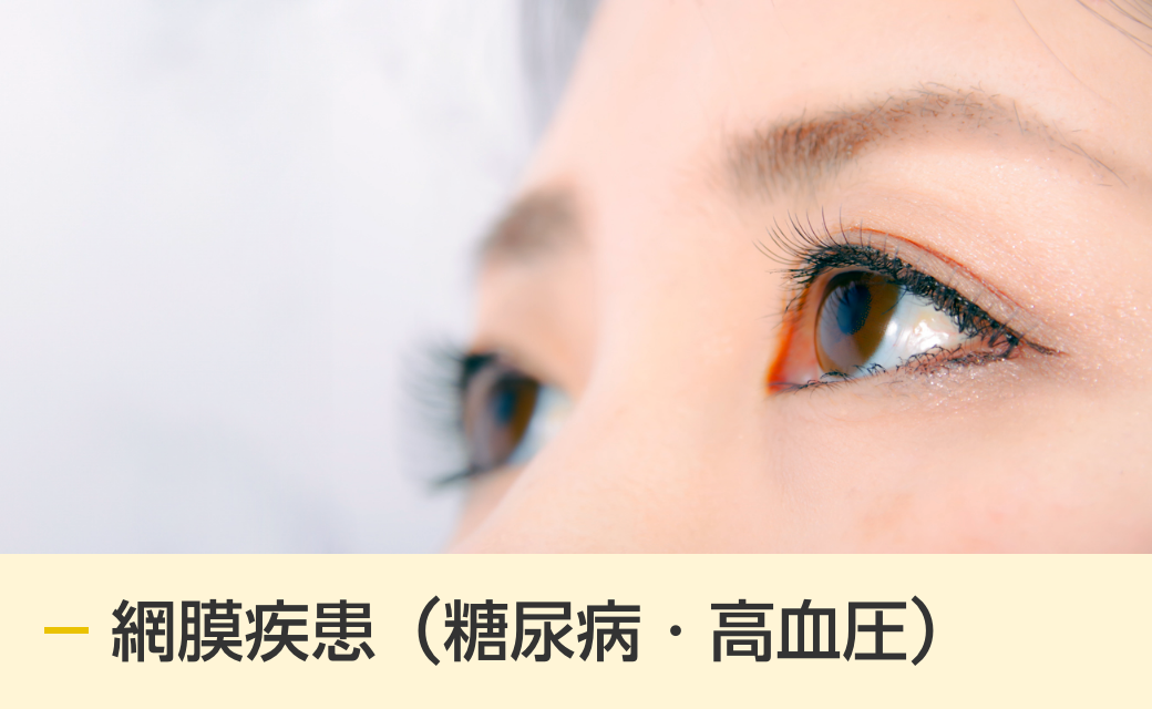 網膜疾患（糖尿病・高血圧）
