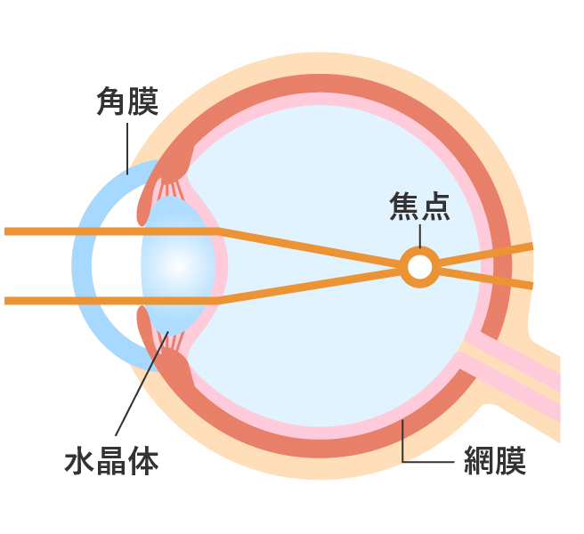 近視の状態