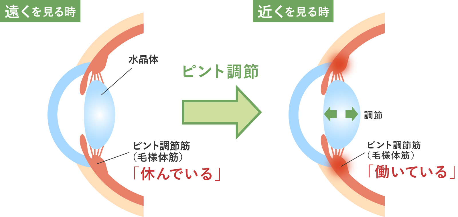 近視