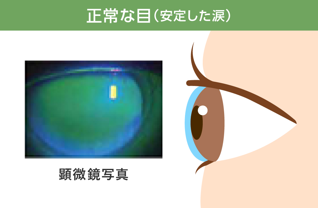 正常な目（安定した涙）