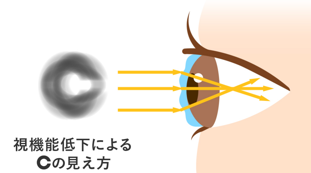 視力低下による見え方