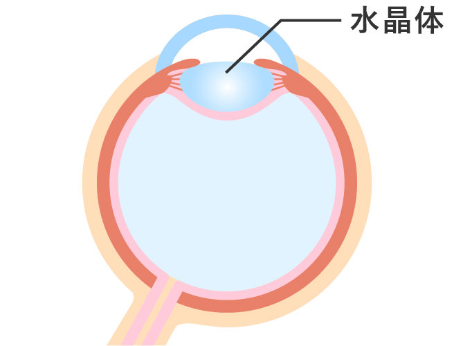 白内障とは